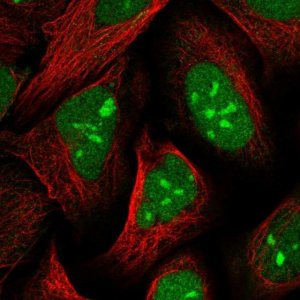 Anti-UBLCP1 antibody produced in rabbit 