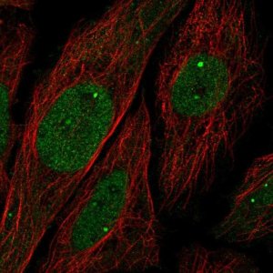 Anti-UBN1 antibody produced in rabbit 