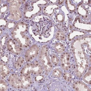 Anti-UBQLN4 antibody produced in rabbit 