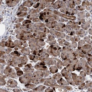 Anti-UBR1 antibody produced in rabbit 