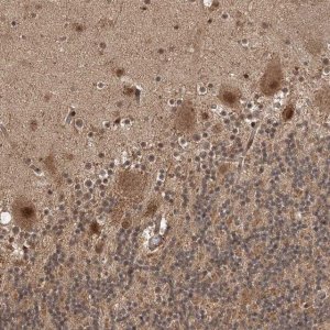 Anti-UBR3 antibody produced in rabbit HPA035390-100UL