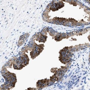 Anti-UBR4 antibody produced in rabbit 