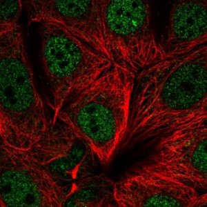 Anti-UBR5 antibody produced in rabbit 