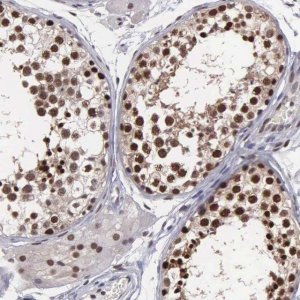 Anti-UBR7 antibody produced in rabbit 