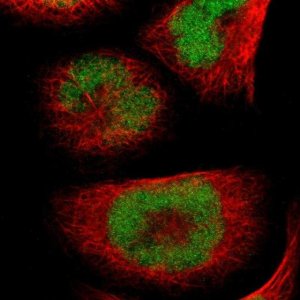 Anti-UBR7 antibody produced in rabbit 