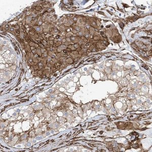 Anti-UBTD1 antibody produced in rabbit 