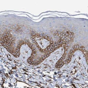 Anti-UBTD1 antibody produced in rabbit 