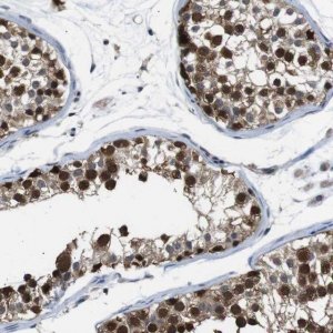 Anti-UBXN1 antibody produced in rabbit 