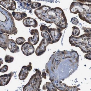 Anti-UBXN1 antibody produced in rabbit 