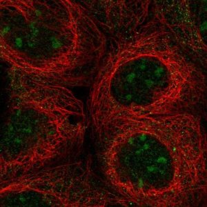 Anti-UBXN11 antibody produced in rabbit 
