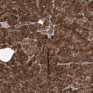 Anti-UBXN4 antibody produced in rabbit 