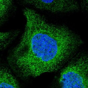 Anti-UBXN4 antibody produced in rabbit 