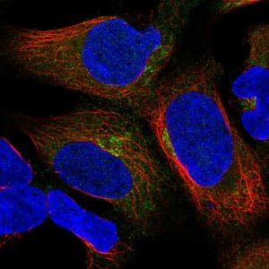 Anti-UBXN6 antibody produced in rabbit 