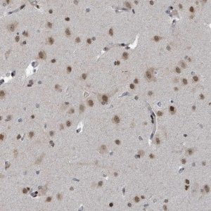 Anti-UCK1 antibody produced in rabbit 