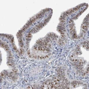 Anti-UCK1 antibody produced in rabbit 
