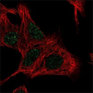 Anti-UCK2 antibody produced in rabbit 