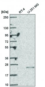 Anti-UCK2 antibody produced in rabbit 
