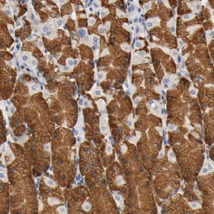 Anti-UCKL1 antibody produced in rabbit 