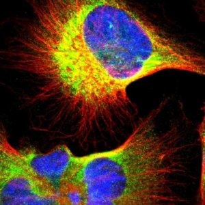 Anti-UCKL1 antibody produced in rabbit 