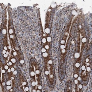 Anti-UCN3 antibody produced in rabbit 