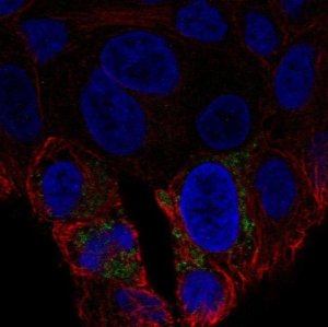 Anti-UCP2 antibody produced in rabbit 