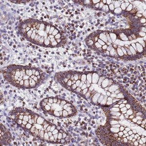 Anti-UEVLD antibody produced in rabbit HPA047134-100UL