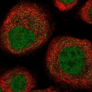 Anti-UEVLD antibody produced in rabbit HPA047134-100UL