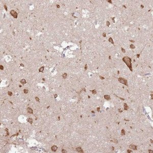 Anti-UGGT2 antibody produced in rabbit 