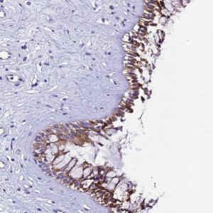 Anti-UGT2A1 antibody produced in rabbit 
