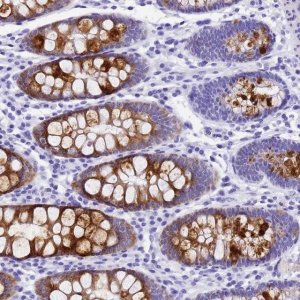 Anti-UGT2B4 antibody produced in rabbit 