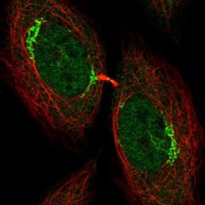 Anti-UHMK1 antibody produced in rabbit 
