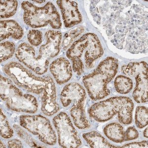 Anti-UHRF1BP1 antibody produced in rabbit 