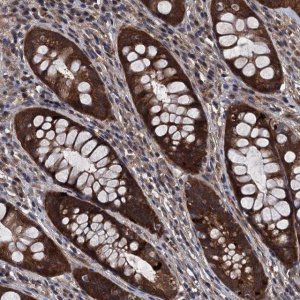 Anti-UHRF1BP1L antibody produced in rabbit 