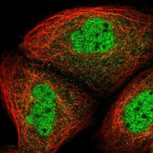Anti-UHRF2 antibody produced in rabbit 