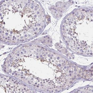 Anti-ULBP3 antibody produced in rabbit 