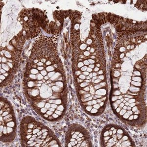 Anti-ULK3 antibody produced in rabbit 