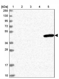 Anti-ULK3 antibody produced in rabbit 