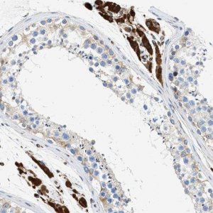 Anti-ULK4 antibody produced in rabbit 