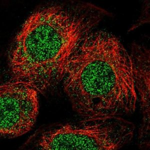 Anti-ULK4 antibody produced in rabbit 