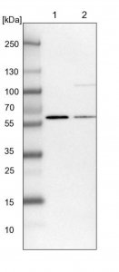 Anti-UMPS antibody produced in rabbit 