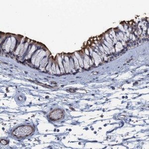 Anti-UNC13A antibody produced in rabbit 