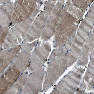 Anti-UNC45B antibody produced in rabbit 