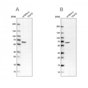 Anti-UPF3B antibody produced in rabbit 