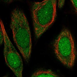 Anti-UPF3B antibody produced in rabbit 