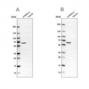 Anti-UPF3B antibody produced in rabbit HPA001882-100UL