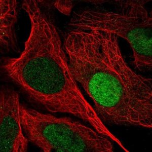 Anti-UPP1 antibody produced in rabbit 