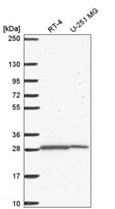 Anti-UPP1 antibody produced in rabbit 