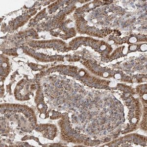 Anti-UQCC1 antibody produced in rabbit 