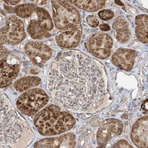 Anti-UQCC1 antibody produced in rabbit 
