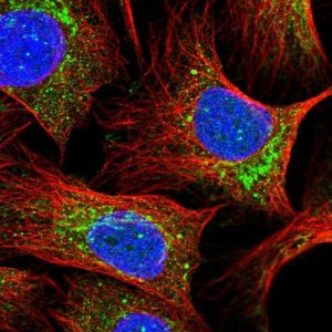 Anti-UQCC2 antibody produced in rabbit 